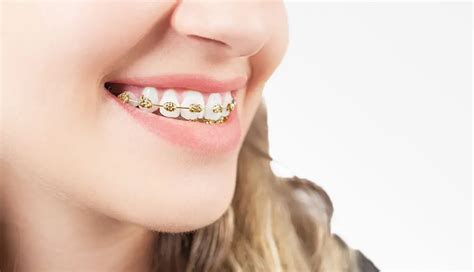 gold brac